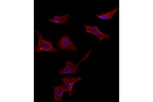 ABIN6265587 and ABIN6272983 staining HepG2 by IF/ICC. (PLIN3 anticorps)