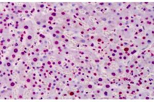 Human Liver: Formalin-Fixed, Paraffin-Embedded (FFPE) (Poly-ADP-Ribose anticorps)