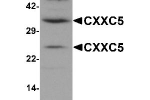 Western Blotting (WB) image for anti-CXXC Finger Protein 5 (CXXC5) (N-Term) antibody (ABIN1031339)