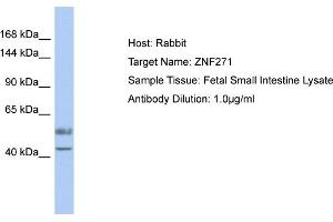 Host: Rabbit Target Name: ZNF271 Sample Type: Fetal Small Intestine lysates Antibody Dilution: 1. (ZNF271 anticorps  (Middle Region))