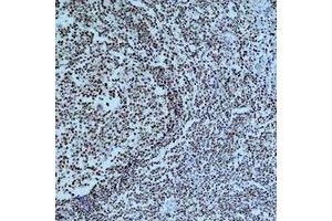 Immunohistochemical analysis of Cleaved PARP1 staining in human tonsil formalin fixed paraffin embedded tissue section. (PARP1 anticorps  (cleaved))