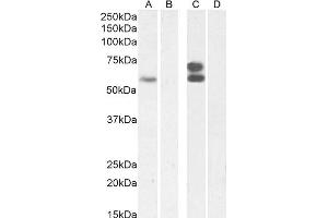 (ABIN570827) (2 μg/mL) staining of Jurkat nuclear lysate (A) + Peptide (B), and (0. (IKZF4 anticorps  (Internal Region))