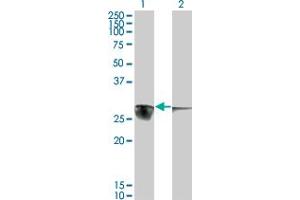 Western Blot analysis of CACYBP expression in transfected 293T cell line by CACYBP monoclonal antibody (M01), clone 2E3.