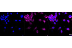 Immunocytochemical staining of Hela cells with RALBP1 antibody (ABIN7800126), 1:1,000). (Recombinant RALBP1 anticorps)