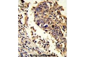 Immunohistochemistry (IHC) image for anti-LUC7-Like (LUC7L) antibody (ABIN3002860)
