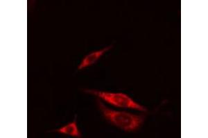 ABIN6267653 staining A549 cells by IF/ICC. (PKD1/2/3/PKC mu (pSer738), (pSer742) anticorps)