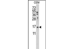Western blot analysis of anti-LSM1 Antibody (C-term) (ABIN389386 and ABIN2839481) in CEM cell line lysates (35 μg/lane). (LSM1 anticorps  (C-Term))