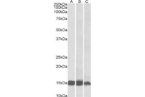 AP32739PU-N FABP3 Antibody staining of Human (A), Mouse (B) and Rat(C) Heart lysates at 0. (FABP3 anticorps)
