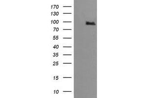 Image no. 4 for anti-Phosphoinositide-3-Kinase, Regulatory Subunit 5 (PIK3R5) antibody (ABIN1500211)