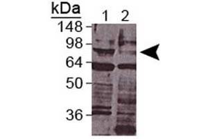 Western blot analysis of daf-3 in wt c. (DAF-3 anticorps)