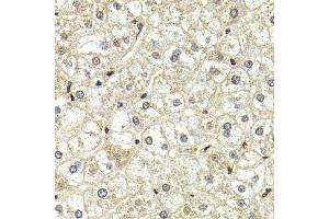 Immunohistochemistry of paraffin-embedded human liver injury using LMNB2 Antibody.