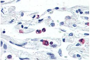 Anti-LGR6 antibody  ABIN1049008 IHC staining of human neutrophils. (LGR6 anticorps  (Internal Region))