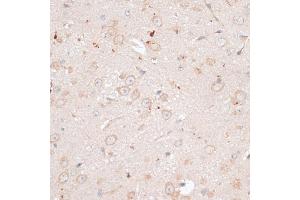 Immunohistochemistry of paraffin-embedded mouse brain using  antibody (ABIN7265735) at dilution of 1:100 (40x lens).