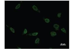 Immunostaining analysis in HeLa cells.