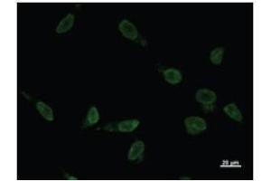 Immunostaining analysis in HeLa cells. (VAX2 anticorps)