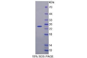 SDS-PAGE analysis of Human HPCAL4 Protein. (HPCAL4 Protéine)