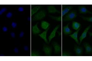 Detection of GLa in Human Hela cell using Polyclonal Antibody to Galactosidase Alpha (GLa)