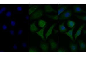 Detection of GLa in Human Hela cell using Polyclonal Antibody to Galactosidase Alpha (GLa) (GLA anticorps  (AA 1-80))