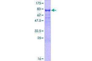 Image no. 1 for Thioredoxin-Related Transmembrane Protein 3 (TMX3) (AA 1-454) protein (GST tag) (ABIN1324224)