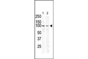 Image no. 1 for anti-Mast/stem Cell Growth Factor Receptor (KIT) (N-Term) antibody (ABIN359890) (KIT anticorps  (N-Term))