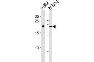 Western Blotting (WB) image for anti-Core-Binding Factor, beta Subunit (CBFB) antibody (ABIN3002868) (CBFB anticorps)