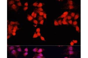 Immunofluorescence analysis of HeLa cells using ENO3 Polyclonal Antibody at dilution of 1:100. (ENO3 anticorps)
