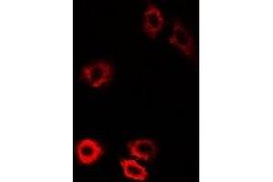Immunofluorescent analysis of HIWI1 staining in U2OS cells. (PIWIL1 anticorps)