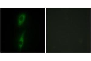 Immunofluorescence analysis of HeLa cells, using ACVL1 Antibody.