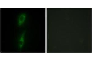 Immunofluorescence analysis of HeLa cells, using ACVL1 Antibody.
