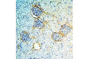 IHC analysis of ANXA3 using anti-ANXA3 antibody (ABIN6719269). (Annexin A3 anticorps  (AA 23-323))