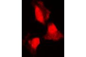 Immunofluorescent analysis of SGK1 staining in HepG2 cells. (SGK1 anticorps  (Center))