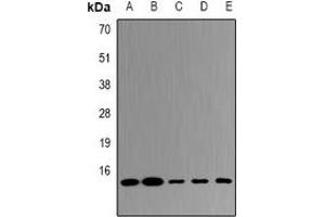 Western blot analysis of UBE2D4 expression in HepG2 (A), MCF7 (B), mouse liver (C), mouse kidney (D), rat lung (E) whole cell lysates. (UBE2D4 anticorps)