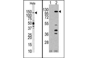 Image no. 1 for anti-Phosphoinositide-3-Kinase, Catalytic, gamma Polypeptide (PIK3CG) (C-Term) antibody (ABIN360712) (PIK3 gamma anticorps  (C-Term))