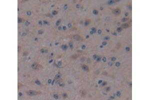 Used in DAB staining on fromalin fixed paraffin- embedded Kidney tissue