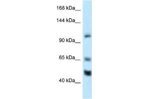 WB Suggested Anti-Rest Antibody Titration: 1. (REST anticorps  (Middle Region))