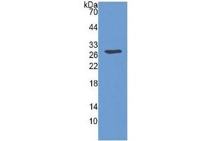WB of Protein Standard: different control antibodies against Highly purified E.