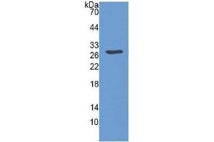 WB of Protein Standard: different control antibodies against Highly purified E. (SERPINB3 Kit ELISA)