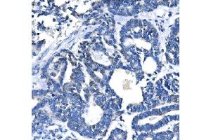 IHC analysis of METTL3 using anti-METTL3 antibody (ABIN7602808). (METTL3 anticorps  (C-Term))
