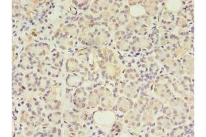 Immunohistochemistry of paraffin-embedded human pancreatic tissue using ABIN7144550 at dilution of 1:100 (GIT2 anticorps  (AA 1-603))