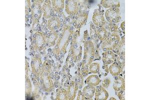Immunohistochemistry of paraffin-embedded rat kidney using PDGFB Antibody (ABIN1874072) at dilution of 1:100 (40x lens). (PDGFB anticorps)