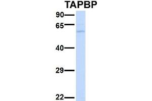 Host:  Rabbit  Target Name:  SERPINA3  Sample Type:  Human Adult Placenta  Antibody Dilution:  1.
