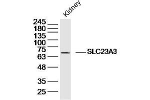Mouse kidney lysates probed with SLC23A3 Polyclonal Antibody, Unconjugated  at 1:300 dilution and 4˚C overnight incubation. (SLC23A3 anticorps  (AA 201-300))