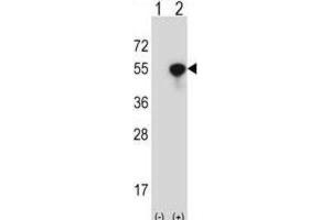 Western Blotting (WB) image for anti-NCK Adaptor Protein 1 (NCK1) antibody (ABIN2997496) (NCK1 anticorps)