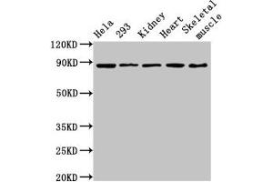 Western Blot Positive WB detected in: Hela whole cell lysate, 293 whole cell lysate, Rat kidney tissue, Mouse heart tissue, Mouse skeletal muscle tissue All lanes: SEMA3A antibody at 3. (SEMA3A anticorps  (AA 357-445))