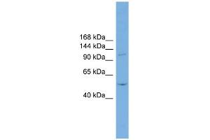 WB Suggested Anti-TNNI3K Antibody Titration:  0. (TNNI3K anticorps  (N-Term))