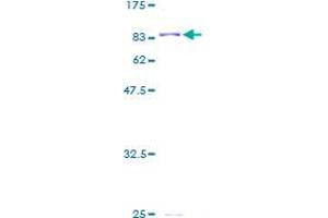 Image no. 1 for Aldehyde Dehydrogenase 4 Family, Member A1 (ALDH4A1) (AA 1-563) protein (GST tag) (ABIN1344838)