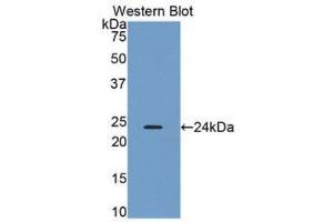 Western Blotting (WB) image for anti-Orosomucoid 2 (ORM2) (AA 19-201) antibody (ABIN1078413)
