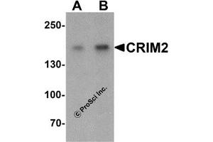 Western Blotting (WB) image for anti-Kielin/Chordin-Like Protein (KCP) (C-Term) antibody (ABIN1030344) (KCP anticorps  (C-Term))