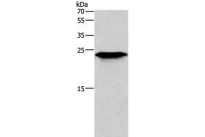 Western Blot analysis of Mouse skeletal muscle tissue using CD269 Polyclonal Antibody at dilution of 1:200 (BCMA anticorps)