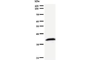 Western Blotting (WB) image for anti-Tyrosyl-tRNA Synthetase (Yars) antibody (ABIN933090) (YARS anticorps)
